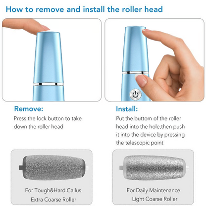 🔥Electric Feet Callus Remover